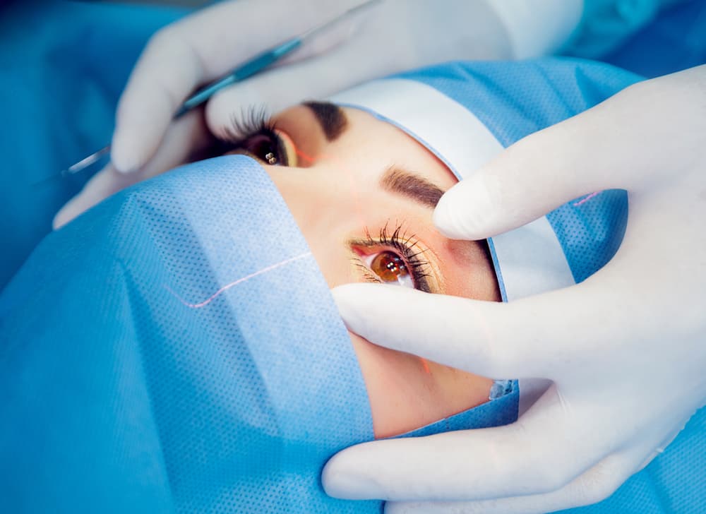 Everything You Need to Know About Laser Eye Surgery